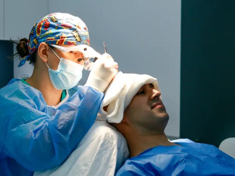 injerto capilar en Madrid